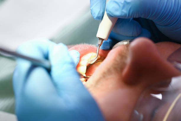 Best Emergency Broken Tooth Repair in Grove City, FL